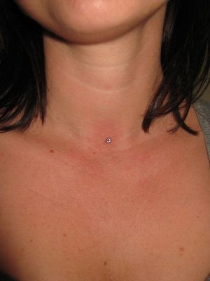 dermal piercing paa halsen 1600 1000 dermal piercing paa halsen 1600 1000